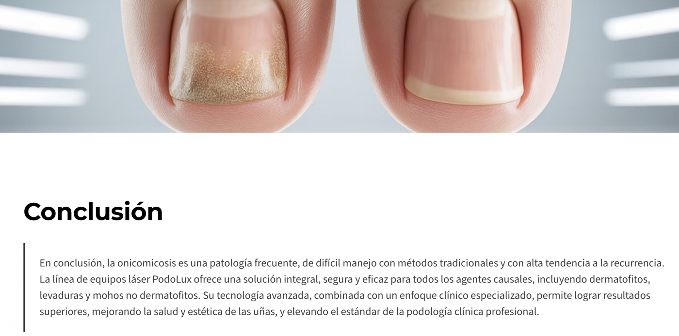 Onicomicosis